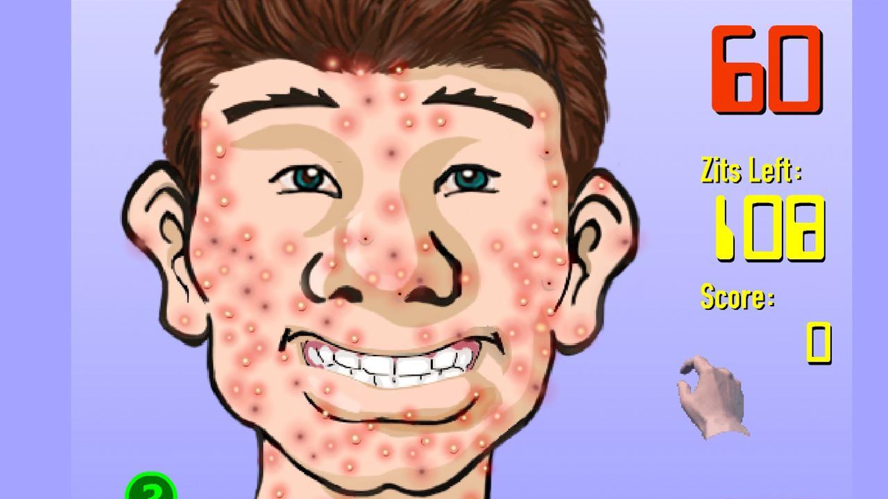 Squeeze Acne